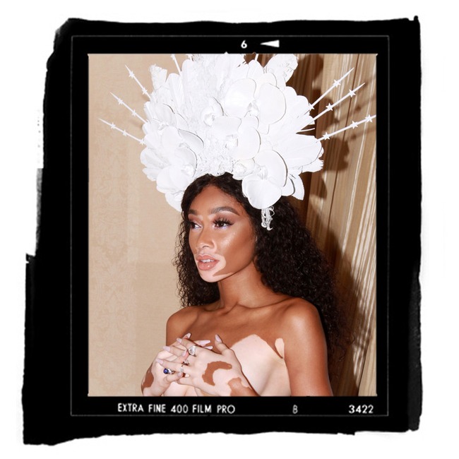 ESC: Winnie Harlow, Met Gala Diary